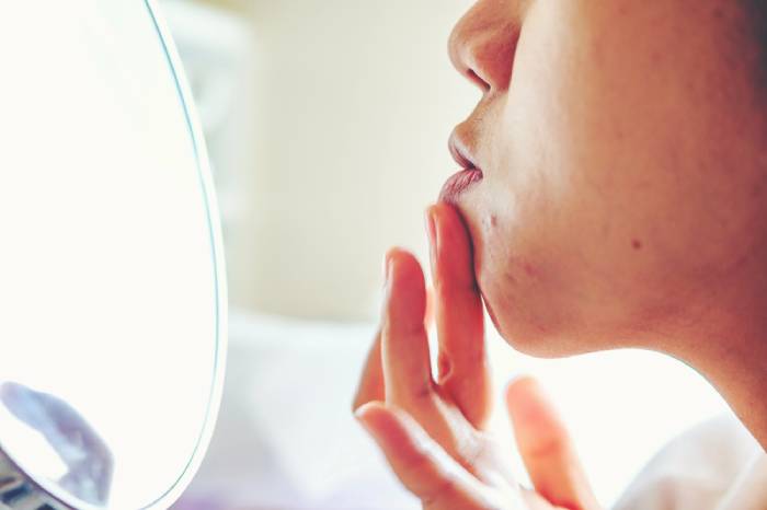cancer causing acne treatments