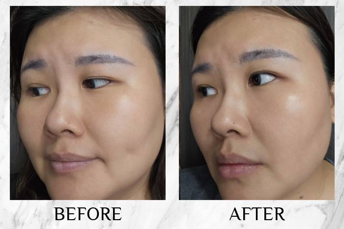 lancome genifique ultimate review before after