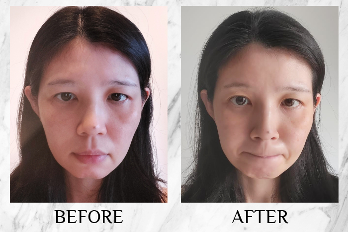 Lancôme Génifique Ultimate Serum review minyi