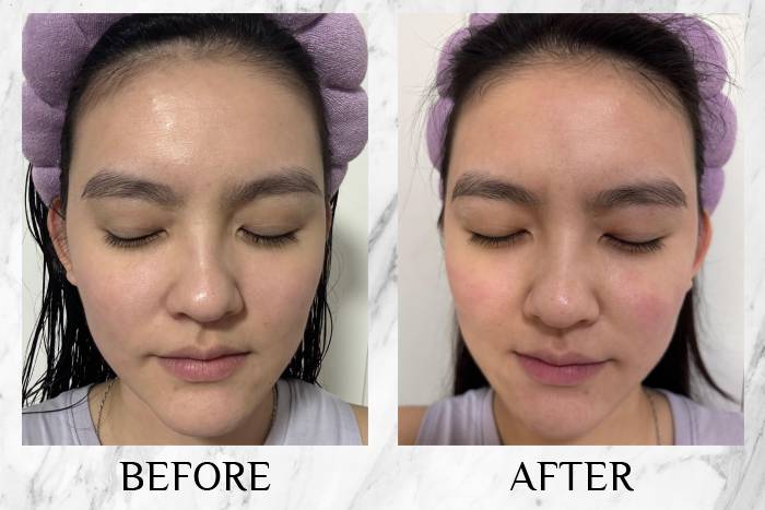 topicrem review apple 2