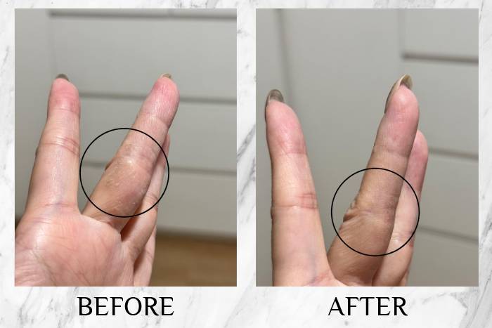 topicrem review apple fingers 1