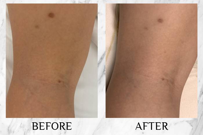 topicrem review candy