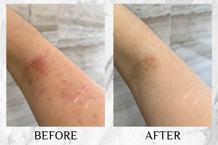 topicrem review jade