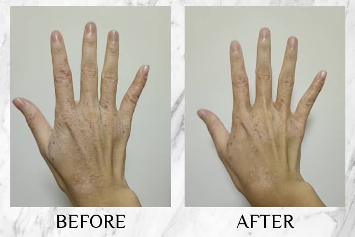 topicrem review jayanne hands