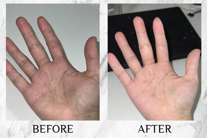 topicrem review jeannie