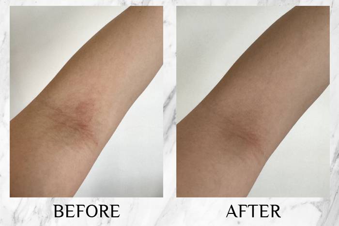 topicrem review karin