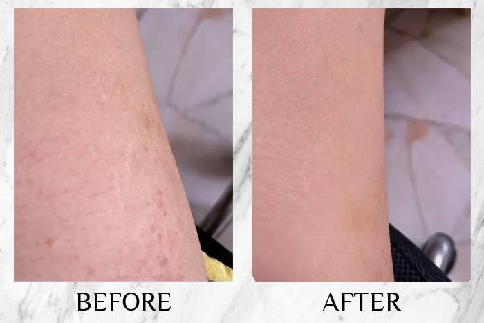 topicrem review peiying