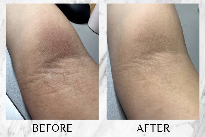 topicrem review sheryl