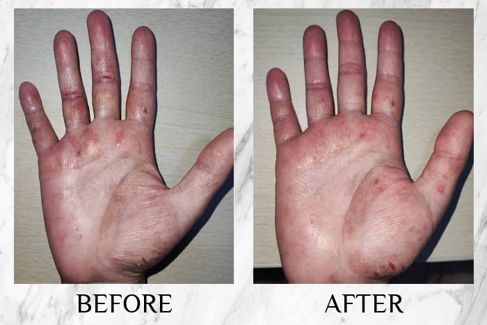 topicrem review wunjoo hands