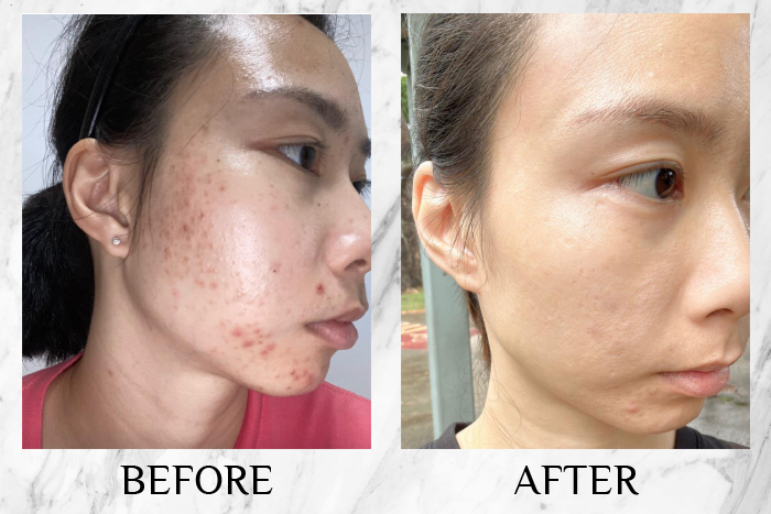 phyto+ whitening drink review before after customer 1