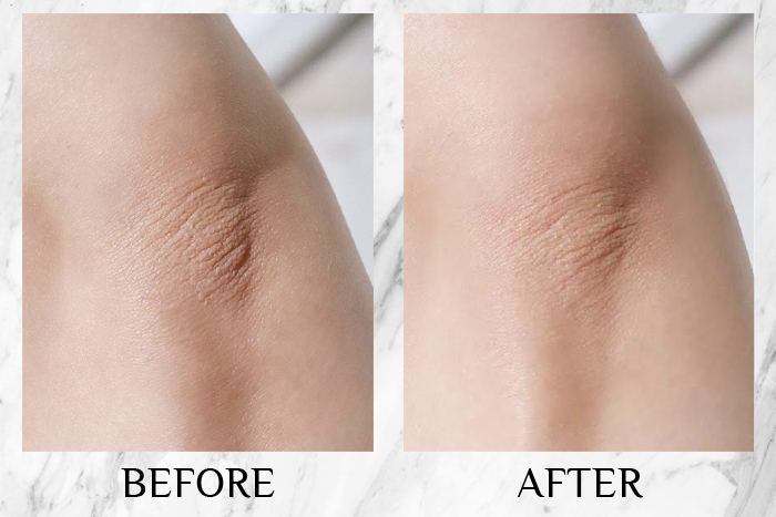 qv gentle wash cream review jing