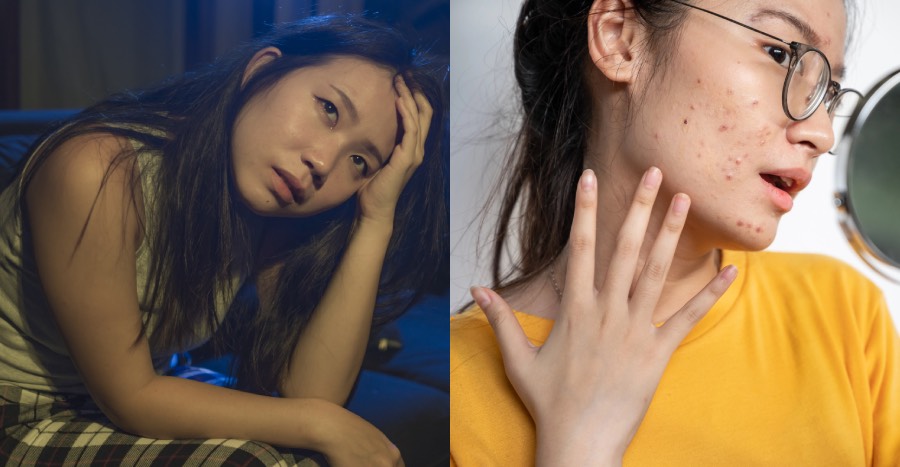 liver and skin health