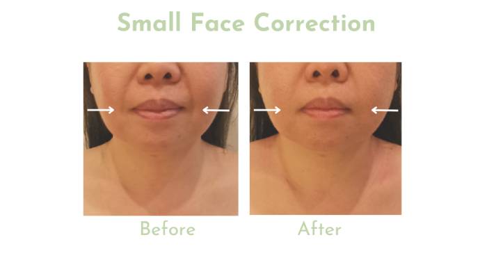 atelier kogao small face therapy