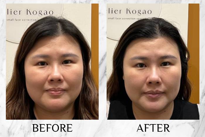 before and after atelier kogao