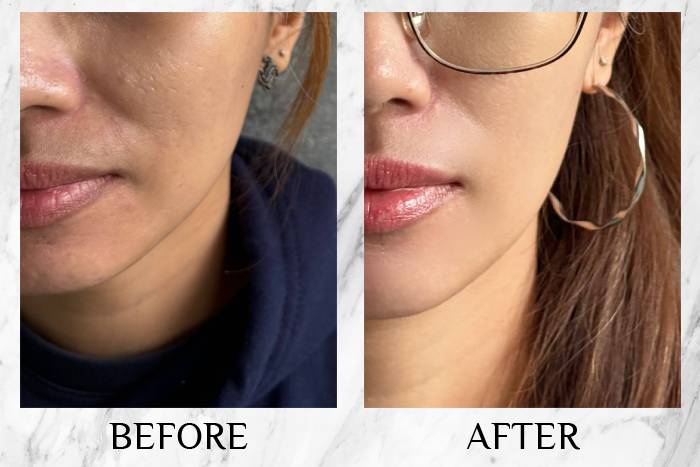 lustre white beauty shot before and after