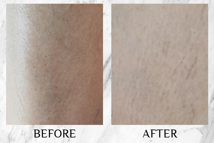 qv gentle wash cream review sharon 1