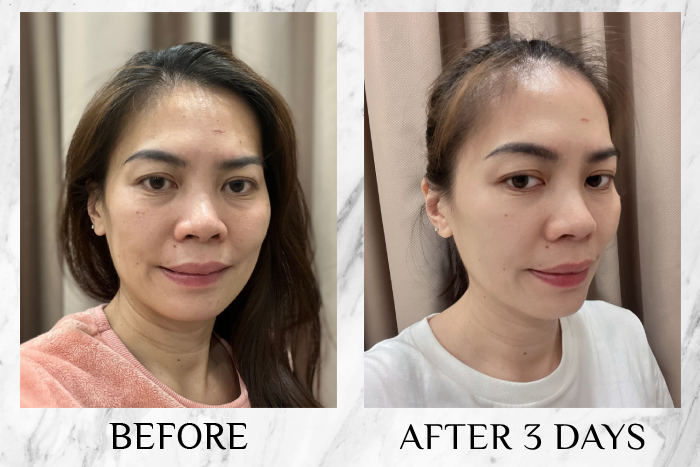 Bioderma Photoderm XDefense Ultra-Fluid SPF50+ review joanne