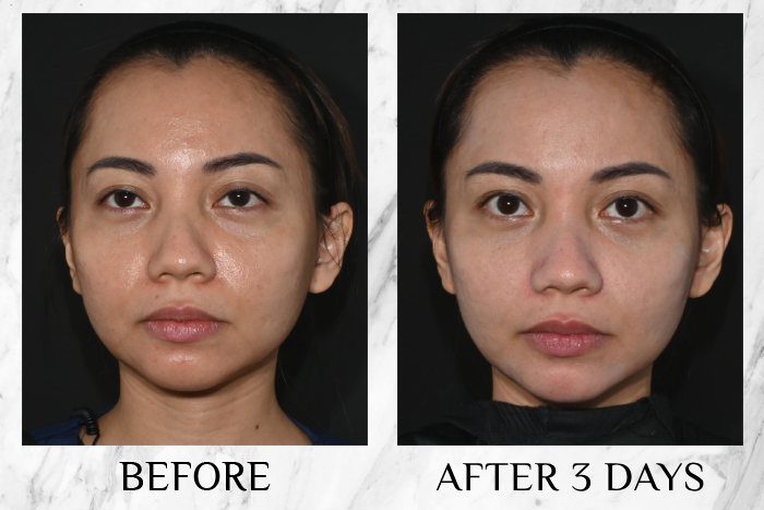 Bioderma Photoderm XDefense Ultra-Fluid SPF50+ review mizri