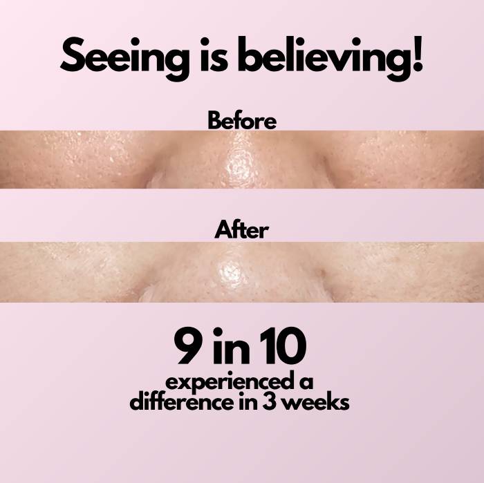 but better serum before after