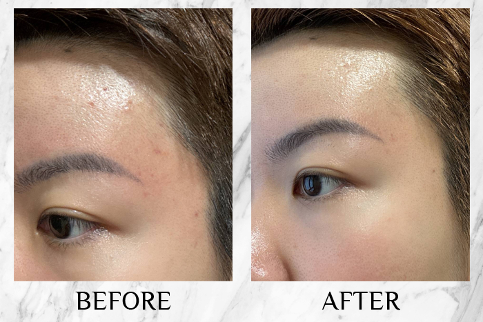 cyspera original+ review before after 1