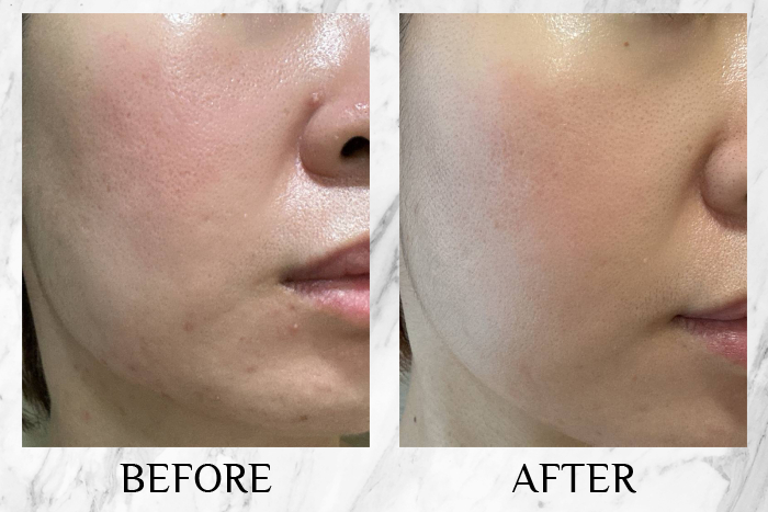 cyspera original+ review before after 2