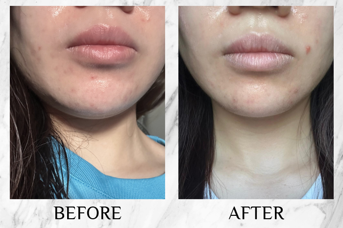 bio-oil skincare oil review alicia