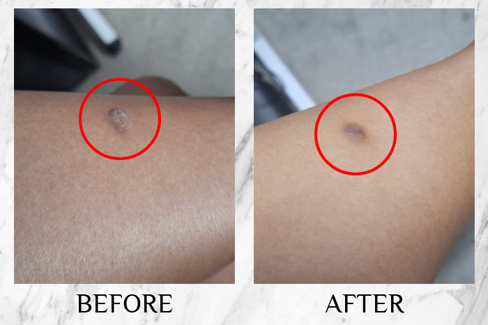 bio-oil skincare oil review charme