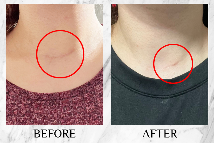 bio-oil skincare oil review emiley (1)