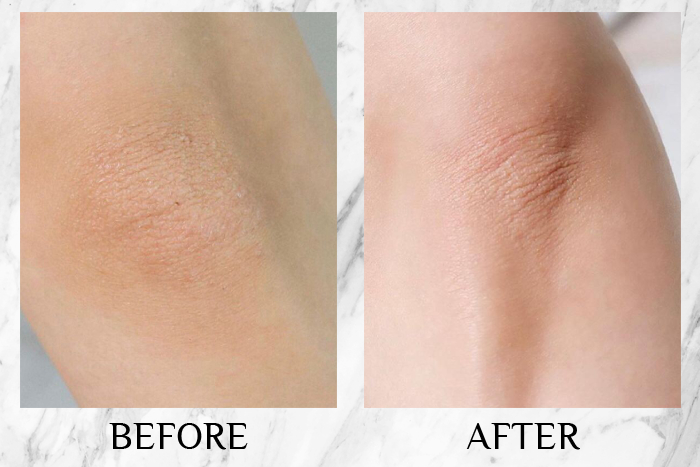 bio-oil skincare oil review jingfang