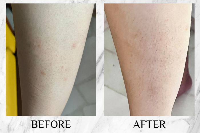 bio-oil skincare oil review pei ying