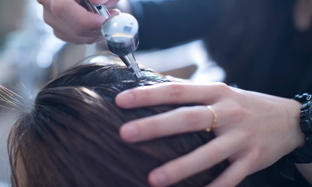 oily scalp treatments - CYL Scalp Lab Solutions.