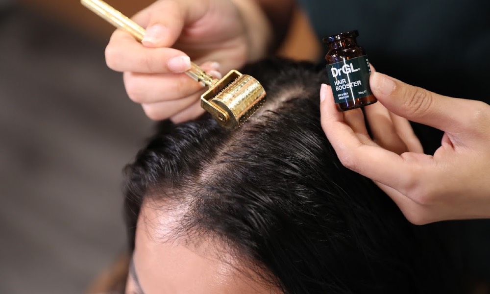 oily scalp treatments - DrHair.