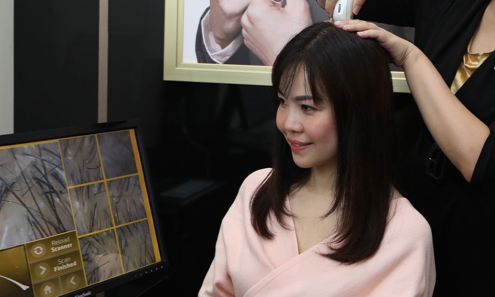 oily scalp treatments - Jonsson Protein