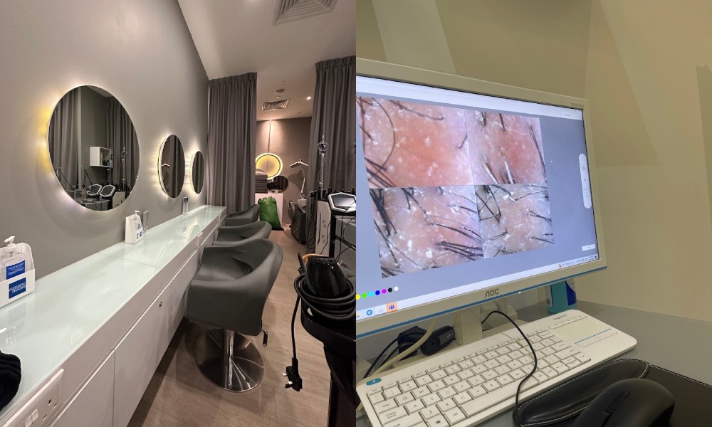 oily scalp treatments - PHS Hairscience.