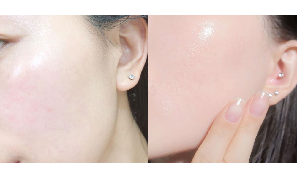3 anti-ageing lifting treatments skin creations