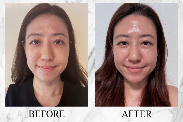 KYOR OUTGLOW Radiance Tri-Factor™ Jelly reviews felicia