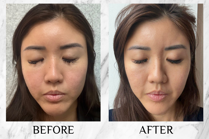 KYOR OUTGLOW Radiance Tri-Factor™ Jelly reviews jacqueline