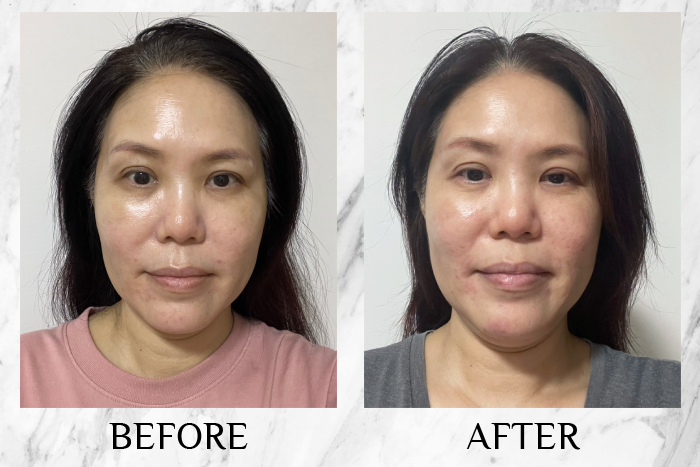 KYOR OUTGLOW Radiance Tri-Factor™ Jelly reviews kym