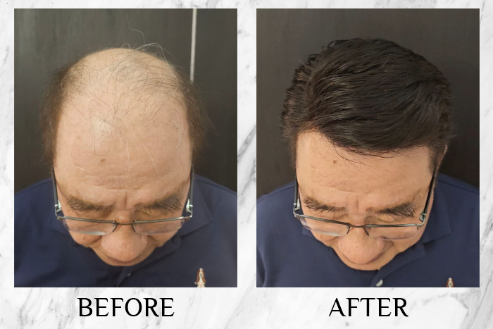 uec review before after1