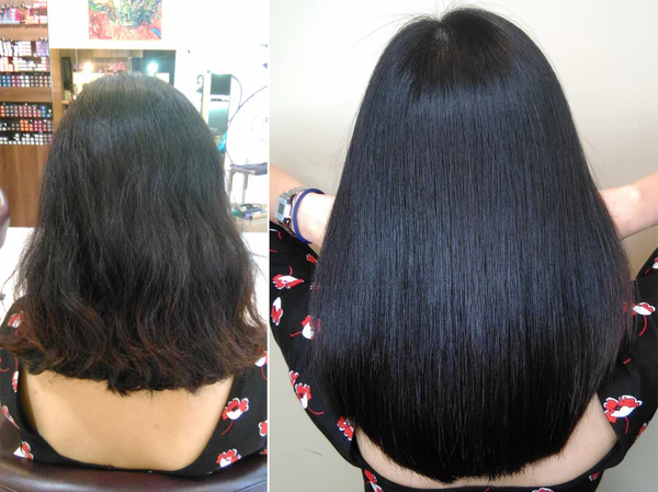 smoothing treatments dvbta 2025 shunji matsuo