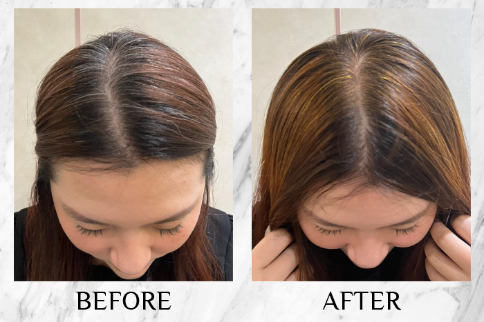Bee Choo Origin Signature Herbal Treatment Review samantha before after
