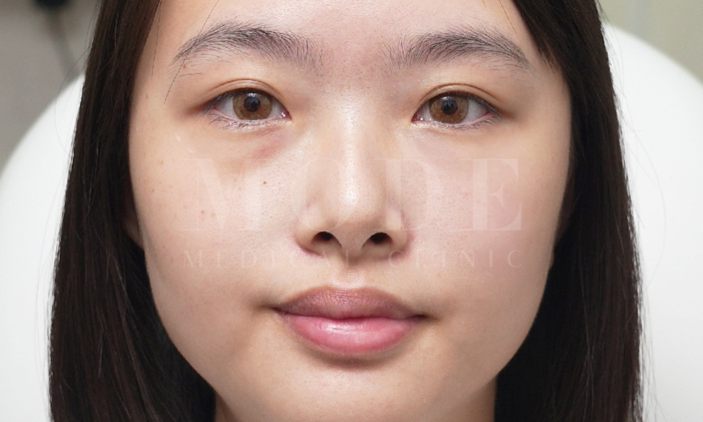 Mode Aesthetic eyebag