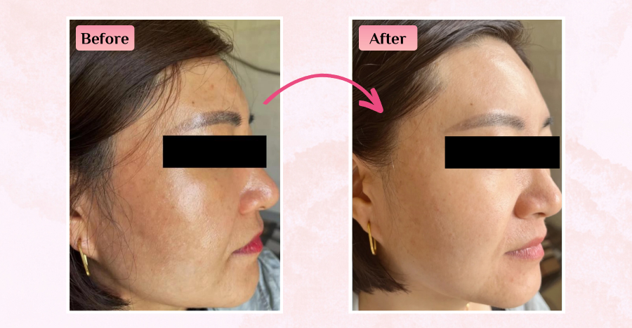 VitaHealth L-Glutathione Plus featured