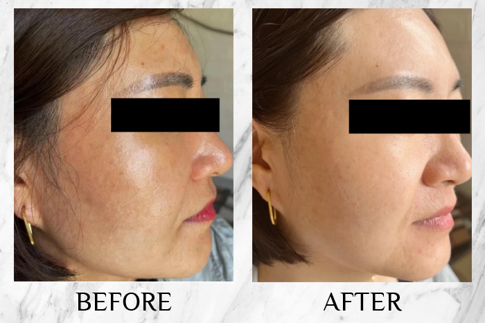 VitaHealth L-Glutathione Plus results