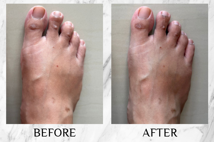 Vytle™ Daily Ceramide Moisturiser reviews candy