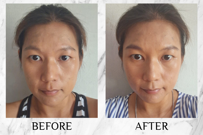 Vytle™ Daily Ceramide Moisturiser reviews charme