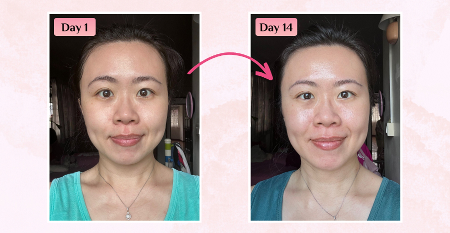 Vytle™ Daily Ceramide Moisturiser reviews featured