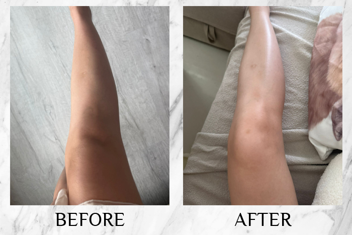 Vytle™ Daily Ceramide Moisturiser reviews melissa