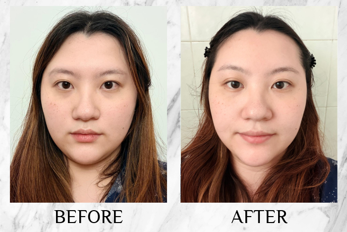 Vytle™ Daily Ceramide Moisturiser reviews samantha