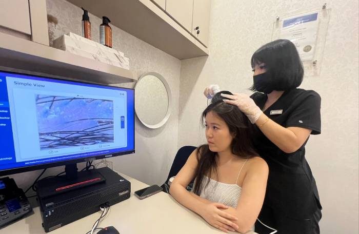 trichokare scalp scan